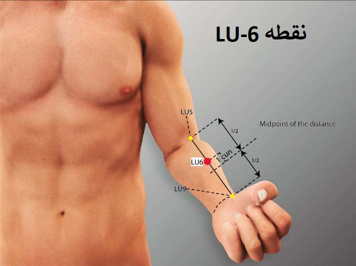 نقطه Lu-6 در طب سوزنی